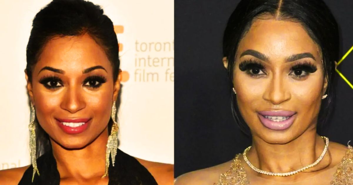 Karlie Redd Before Plastic Surgery Pics