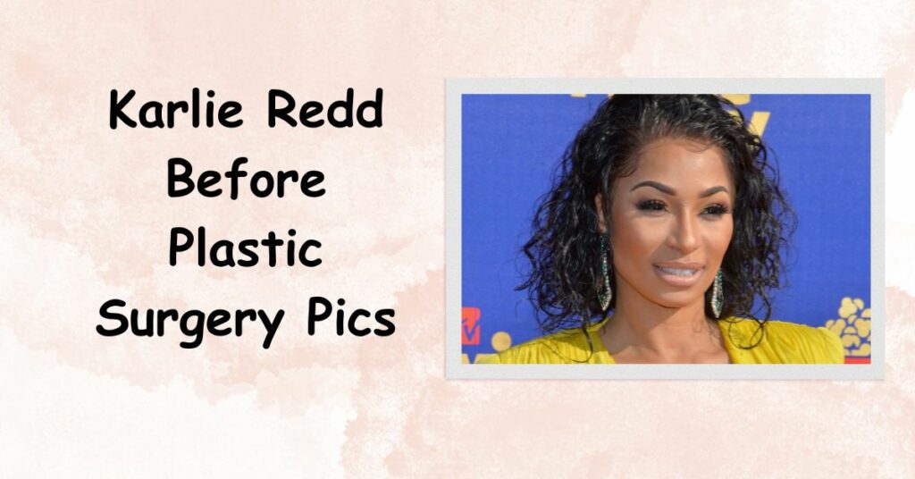 Karlie Redd Before Plastic Surgery Pics