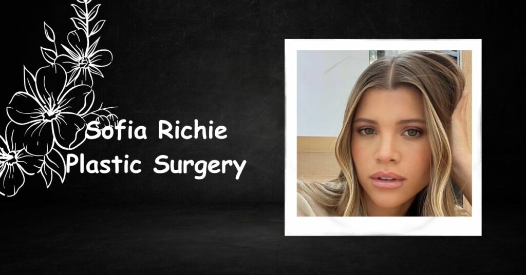 Sofia Richie's Glass Skin Is Thanks to Plastic Surgery!