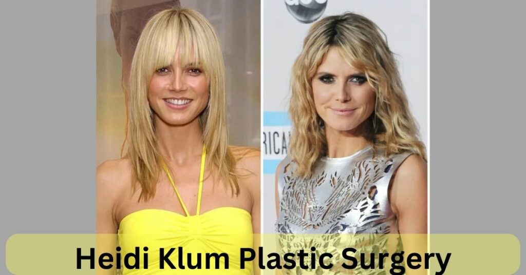 Heidi Klum Plastic Surgery