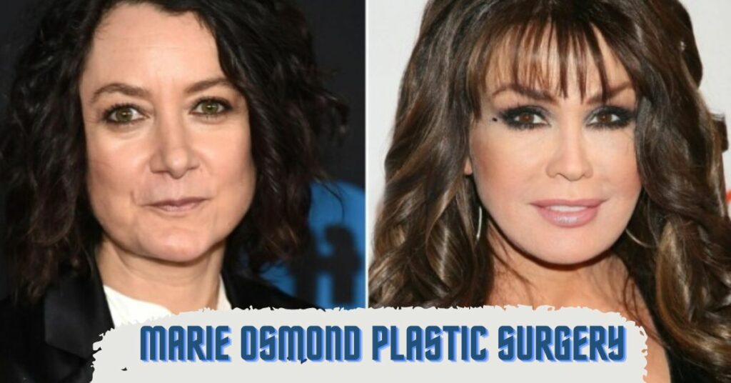 Marie Osmond Plastic Surgery