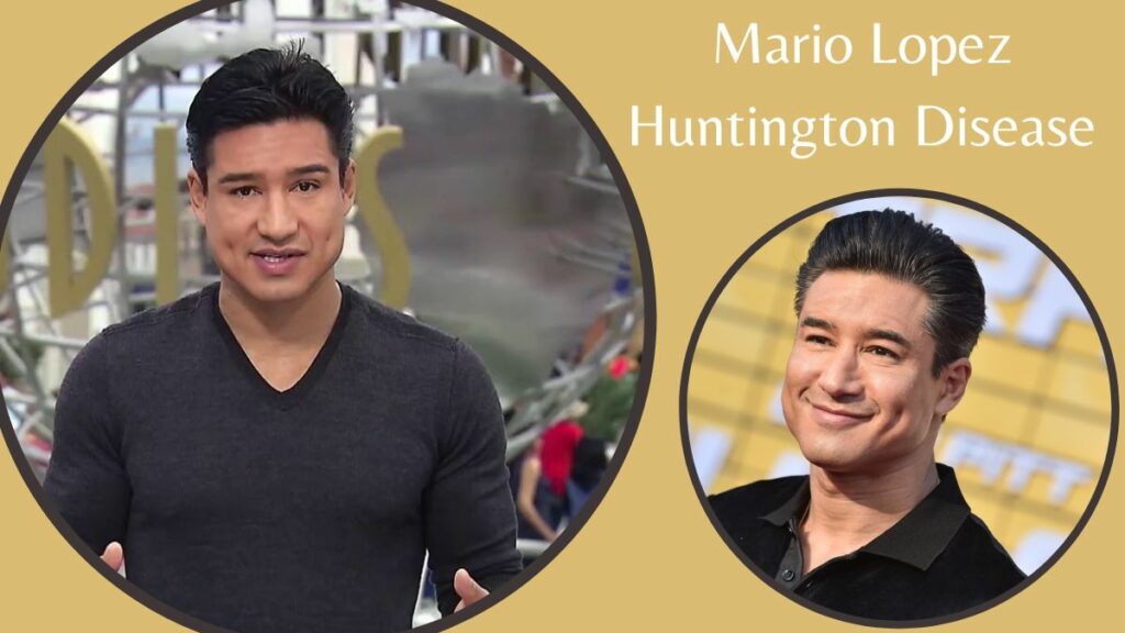 Mario Lopez Huntington Disease